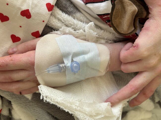 Fixace infuze EB Centrum I.